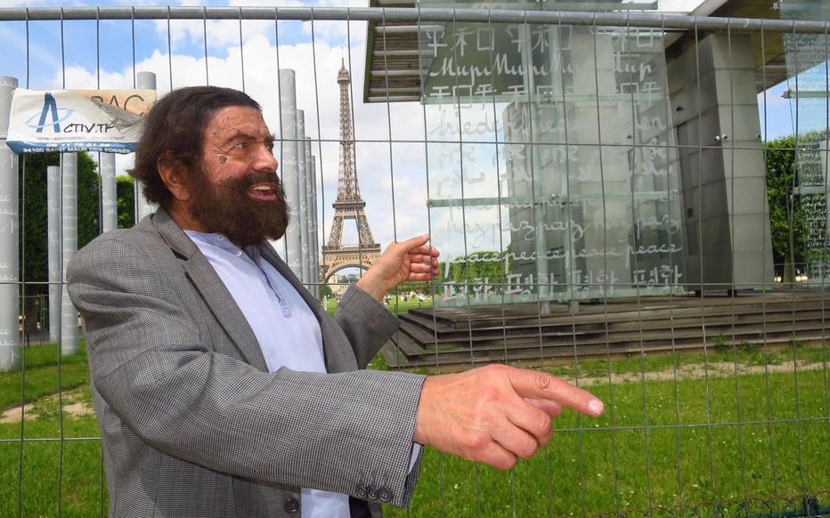 découvrez nos services experts en rénovation du mur de la paix, alliant respect du patrimoine et techniques modernes pour un résultat durable et esthétique.